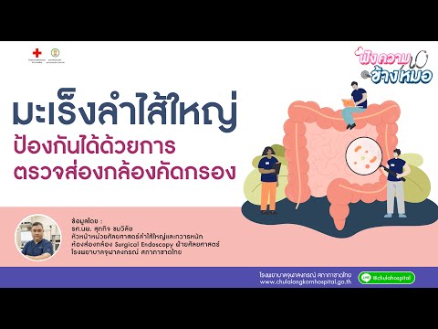 ฟังความข้างหมอ | มะเร็งลำไส้ใหญ่ ป้องกันได้ด้วยการตรวจส่องกล้องคัดกรอง