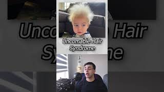 Children With Unusual Medical Conditions 🤔