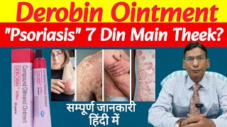 Psoriasis ka Best Treatment? Derobin Ointment Full Details Hindi l #derobinointment