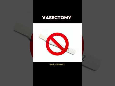 Vasectomy Procedure Simplified: Animated Visuals