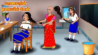 மாணவரின் தலையில் பேன் Tamil Kathaigal | Tamil Stories | Tamil Moral Stories