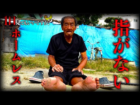 足の指を失ったホームレスに1日密着したら感動的だった...【1日見てもいいですか？】