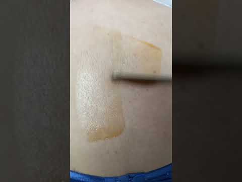 #Beautytips#Shoulderwaxing#Newvideo👍👍