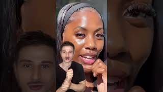 Hyperpigmentation Skincare Routine. #dermreacts #skincare