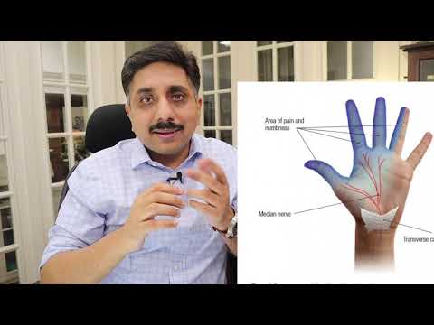 Carpal Tunnel Syndrome: How to Avoid Surgery - Treatment with Natural Homeopathic Medicines