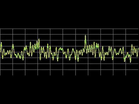 Cartilage Diseases - Rife Frequencies