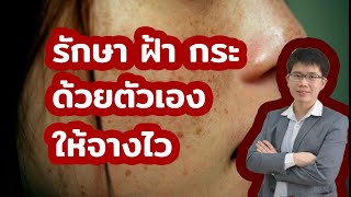 รักษาฝ้า/กระ ทางเลือกใหม่ ทำได้เอง l 10นาทีกับหมอต่อ
