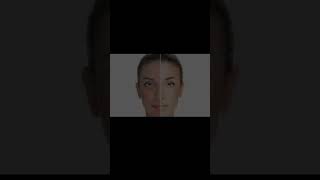🌙 Creams for Dark Body Parts. 🌙#DrAvani #shorts #shortvideo #viralvideo #skincare