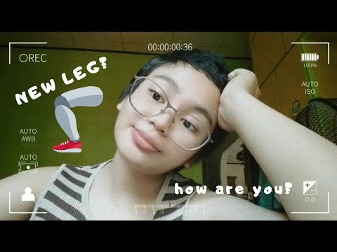 how are you? (new leg yayy!)