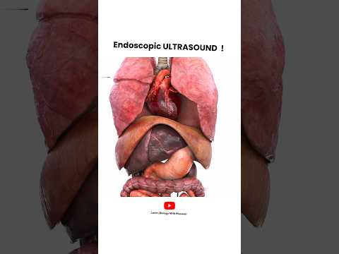 Endoscopic Ultrasound procedure | Short Animated Video