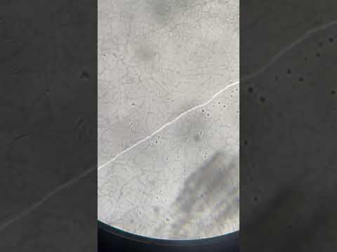 motile bacteria in microscope 😀😀in practical class #mbbs #neetmotivation#mbbsstudent #viral #shorts