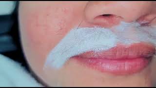 How to do upper lips waxing  safely , no peeling skin, or redness or bumps, #youtubeshorts#shorts