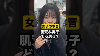 【肌荒れ必見】肌荒れ男子どう思う？#モテ #恋愛 #スキンケア #インタビュー