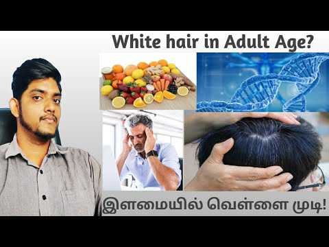 Premature Grey Hair(White hair) in Adult Age...... இளமையில் வெள்ளை முடி...Episode -24