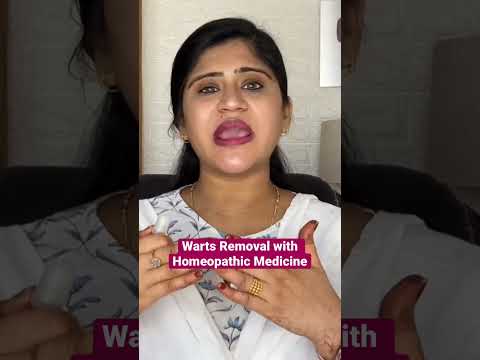 Remove warts with Homeopathic Medicine #shorts #homeopathy