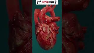 💔 Heart Attack Kya Hota Hai#shorts #hearthealth #HeartAttack #HeartDisease