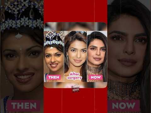 How Priyanka Chopra was REJECTED because of her NOSE? 😱  #priyankachopra #nickjonas #bollywood