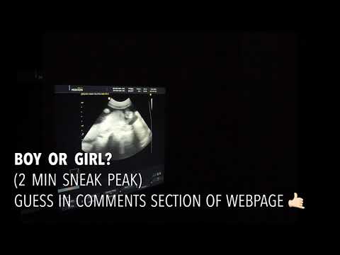Preview of Baby #2: The 20 Week Check-up / Gender Reveal