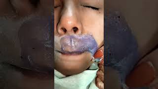 upper lips #waxing #viralshorts #comment #like #skincare #followback #youtubeshorts