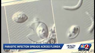 Stomach illness spreading across Florida