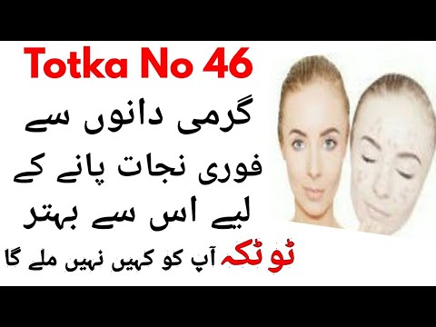 Totka No 46-Garmi Dano Ka Fori Khatama-Garmi Ke Dano Ka Ilaj
