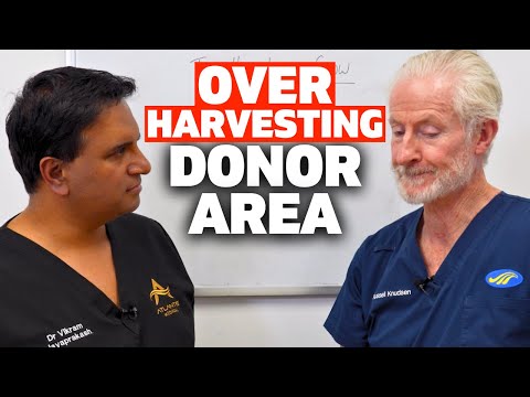 The Problem With Over Harvesting In The Donor Area | The Hair Loss Show