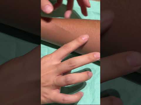 #shorts #infusion #route establishment #peripheral venous access establishment #blood sampling #n...