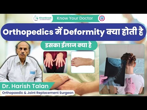 जाने Orthopedics में Deformity क्या होती है इसका ईलाज क्या है