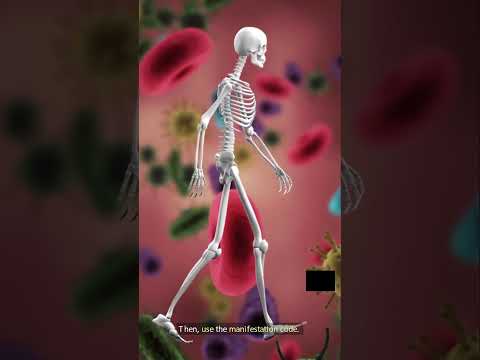 What Is a Manifestation Code in Medical Coding