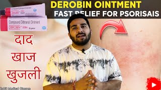 Derobin Ointment uses in hindi | Dithranol Ointment | Ringworm / Scabies / Itching