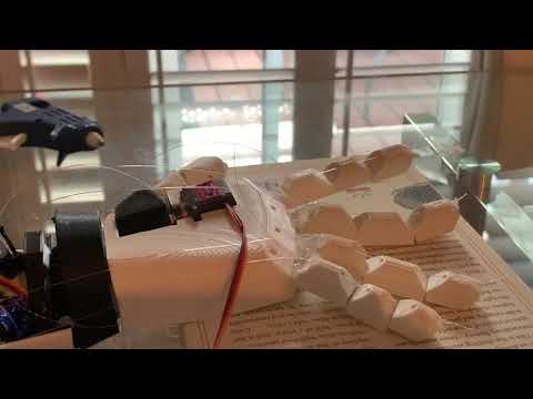 Vision Arm: 3D Prostehtic Arm Demo