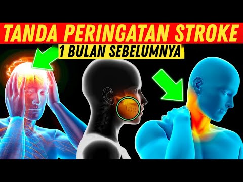 ⚠️ 7 Tanda Stroke Sebulan Sebelum Terjadi 🧠 | Waspadai Gejala Ini & Selamatkan Nyawa! 🚑💡