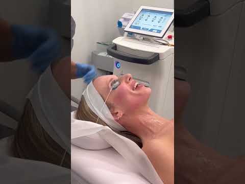 Broadband Light Forever Young treatment. Delays aging process and changes the skin cell to act young