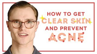 How To Get Clear Skin & Prevent Acne - Skincare Tips for Men