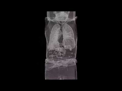 仙台西多賀病院　CT画像動画