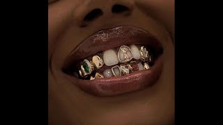 [FREE FOR PROFIT] Melodic Type Beat - "Different"