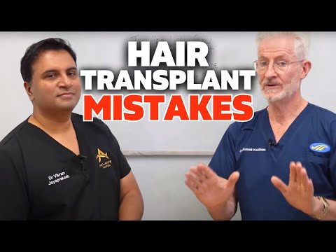 Top 3 Mistakes In Hair Transplant Surgery