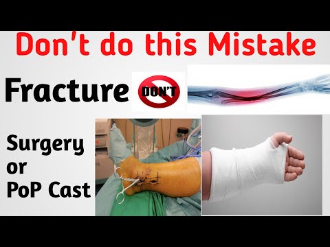 Don"t do this Mistake after the Fracture❌