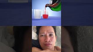 Poison #poison #reaction #fypシ゚viral #followforfollowback
