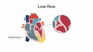 Diagnosing paradoxical low flow