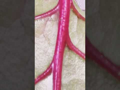 இது என்ன இலைனு தெரிந்தால் சொல்லுங்க!!! | Any guesses?? wat leaf is this? | #shorts #garden