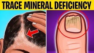 7 Signs Your Body Need Trace Minerals