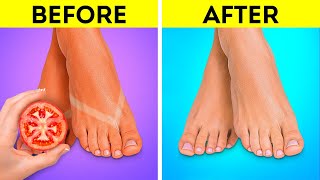 Foot Care Hacks 🦶👣 Smart Hacks To Keep Your Feet Nice And Smooth