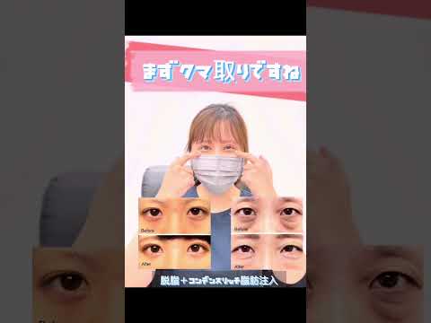 頼れる女医！りえ先生に得意な施術を聞いてみた！#湘南美容クリニック #湘南美容クリニック札幌　#クマ取り #脂肪注入 #婦人科形成