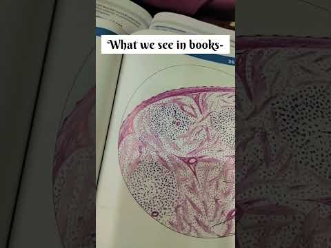 what we read Vs what we write in exams #neetexam #dentist #dentistry #medical #medicalstudent