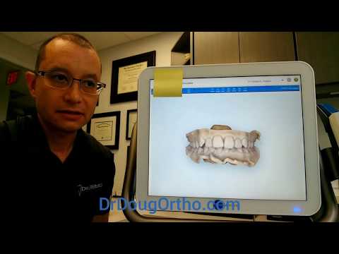 See your treatment simulated at your consult!