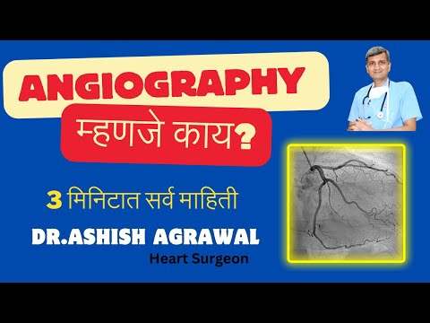 अँजिओग्राफी म्हणजे काय ते जाणून घ्या | what is angiography | Angiography test