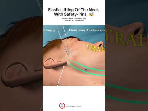 Elastic Lifting of the Neck with Safety-pins 🤯! Animated Video