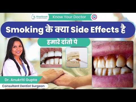 जाने Smoking के क्या Side Effects है हमारे दांतो पे || Dr. Anukriti Gupta