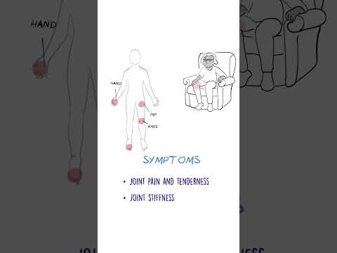 Osteoarthritis EXPLAINED #jointpain #arthritis #healthsketch